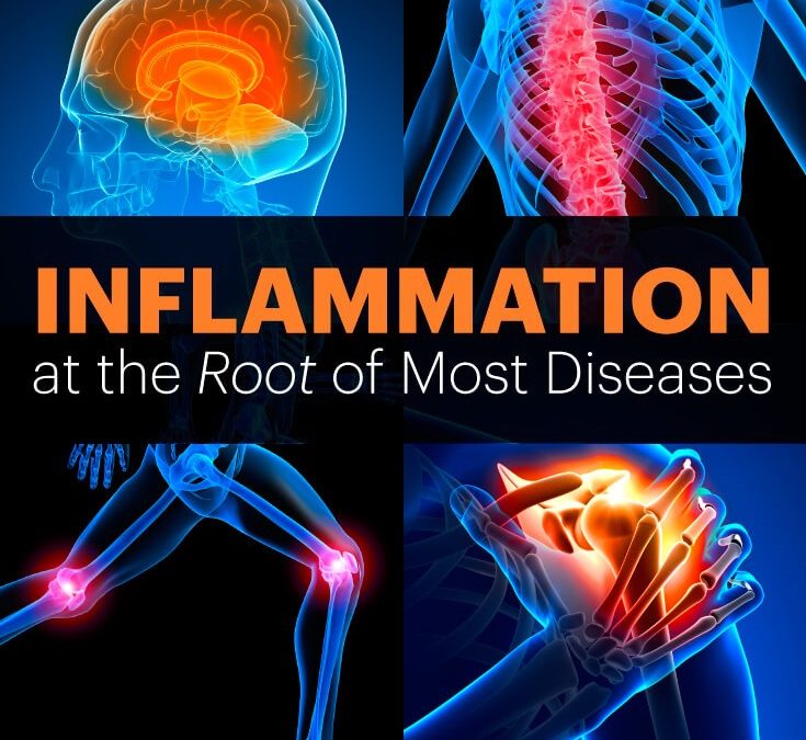 Inflammation Masterclass